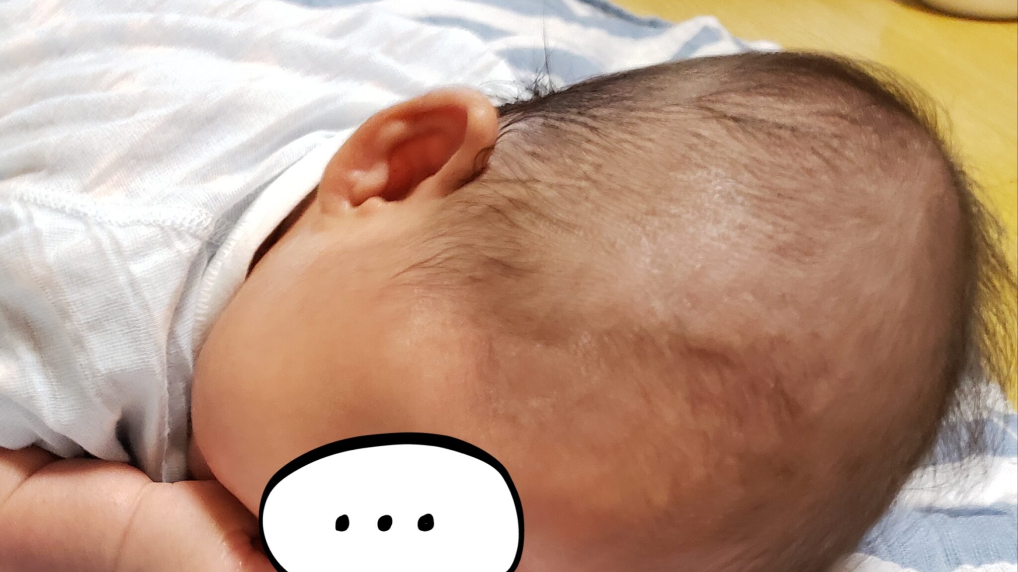 赤ちゃんの頭の形がいびつ…これって治るの？私の後悔と1歳半を過ぎた現在｜トリイク